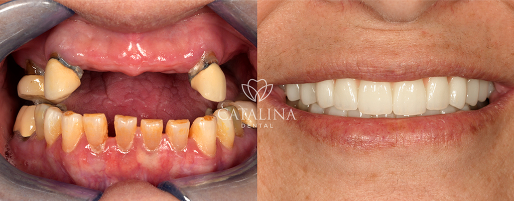 Patient's Before & After