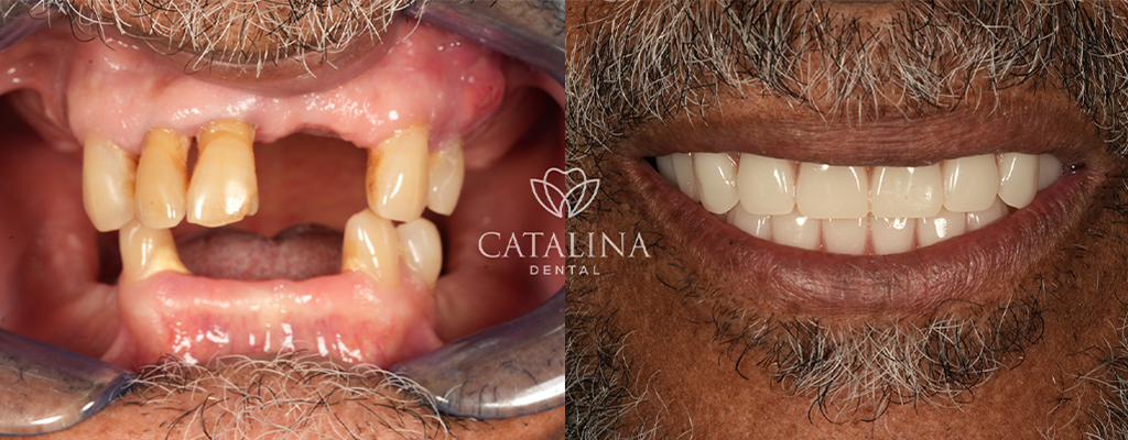 Patient's Before & After