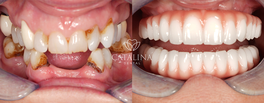 Patient's Before & After