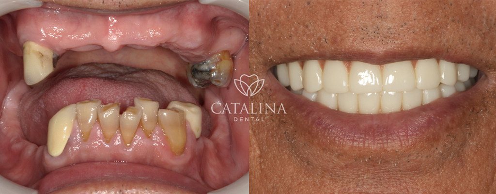 Patient's Before & After