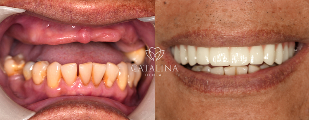 Patient's Before & After