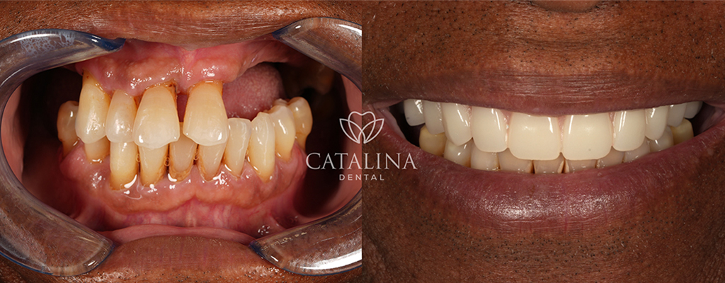 Patient's Before & After