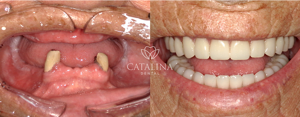 Patient's Before & After