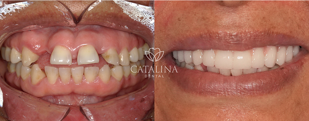 Patient's Before & After