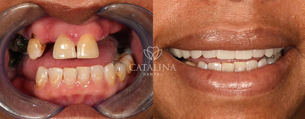 Patient's Before & After