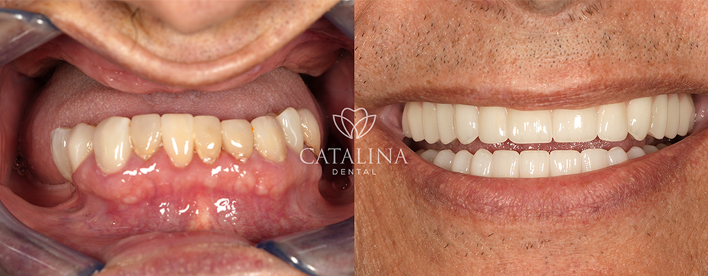 Patient's Before & After