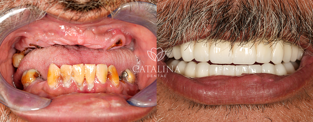 Patient's Before & After