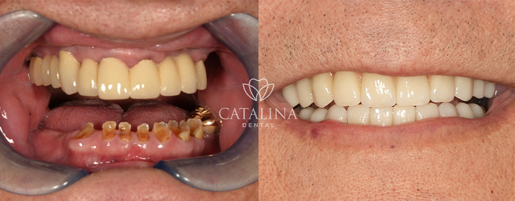 Patient's Before & After